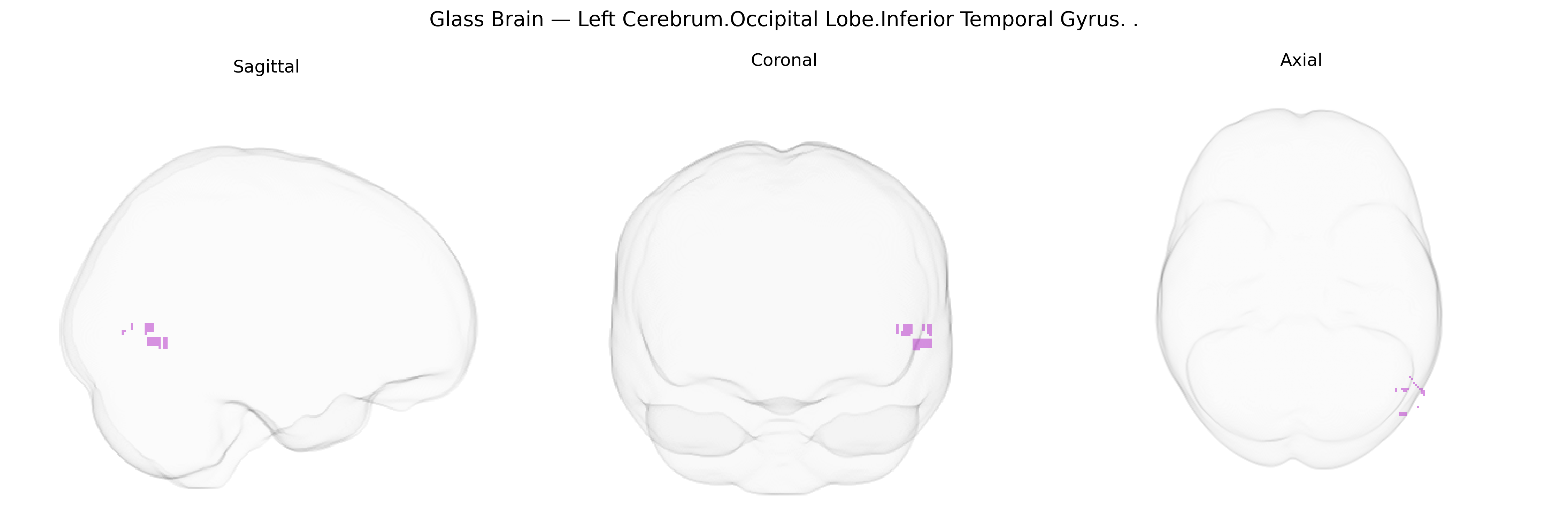 Triplanar Ghost Brain