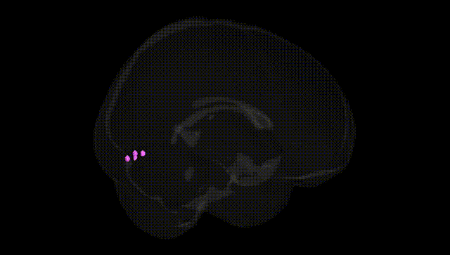 Full Brain Black
