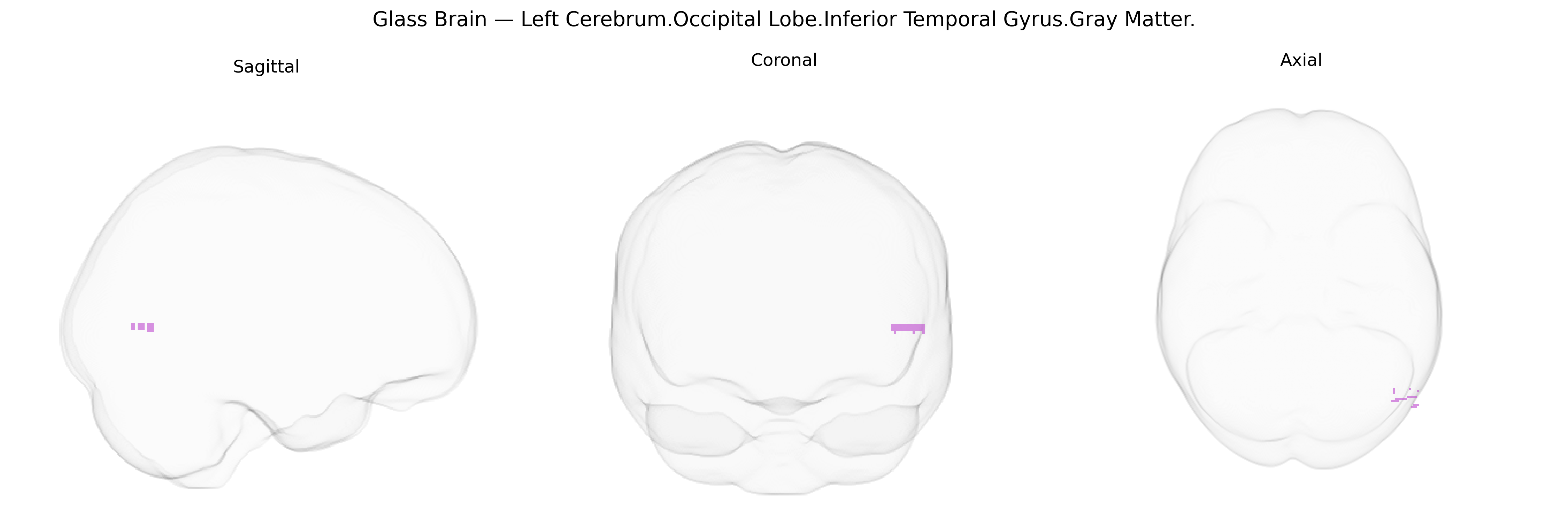 Triplanar Ghost Brain