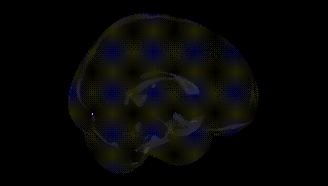 Full Brain Black