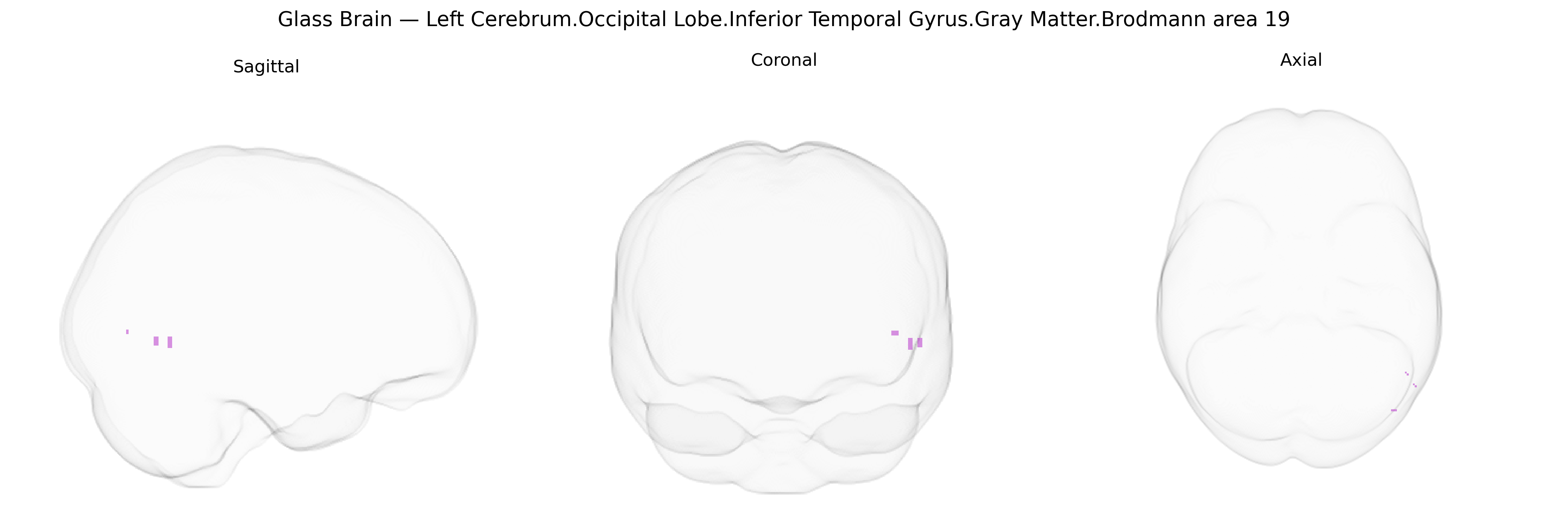 Triplanar Ghost Brain