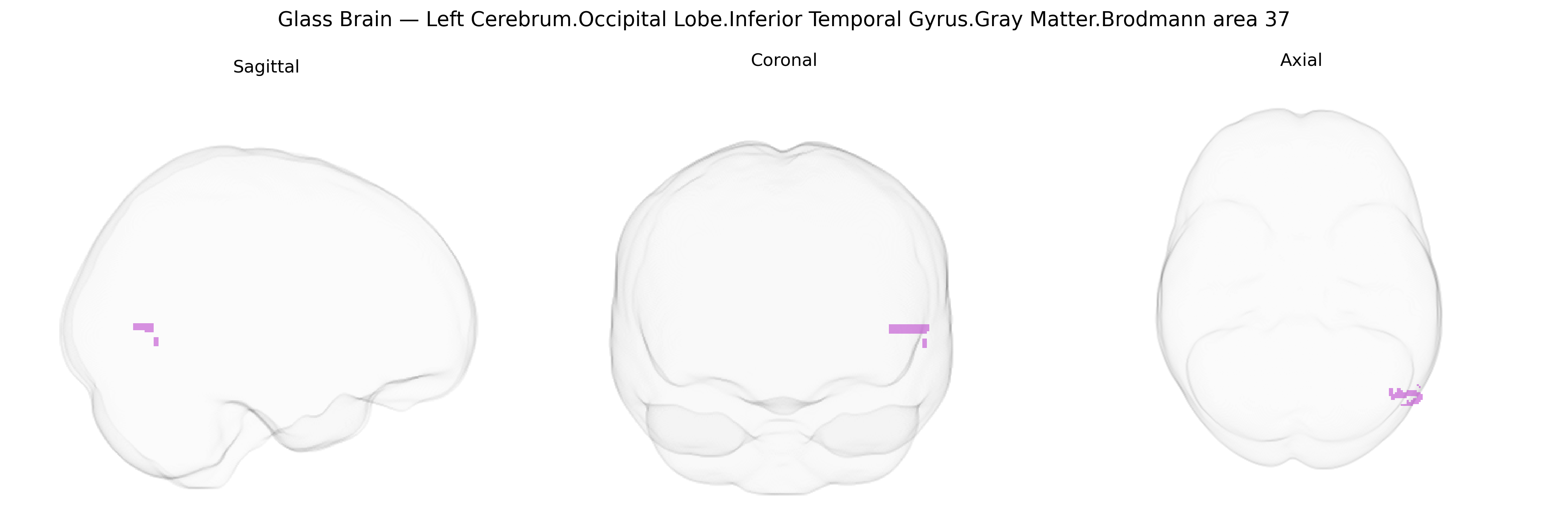 Triplanar Ghost Brain