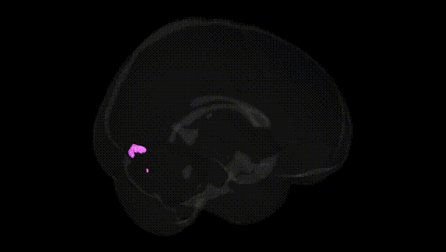 Full Brain Black