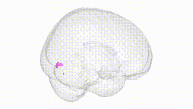 Full Brain White