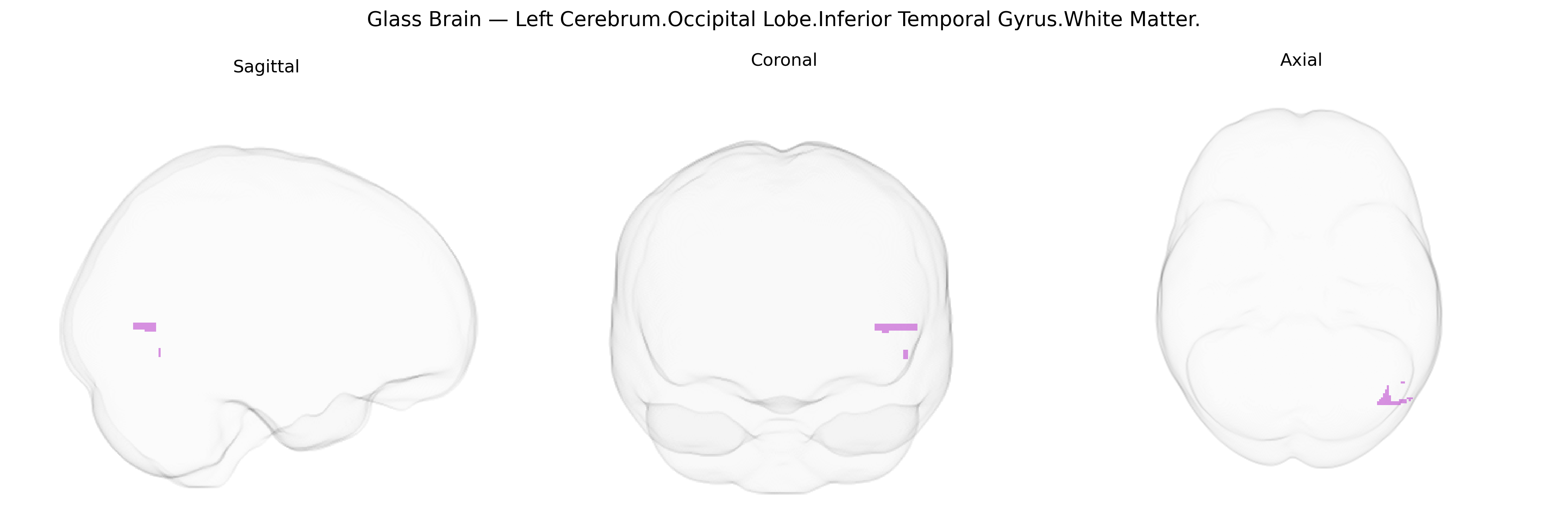 Triplanar Ghost Brain