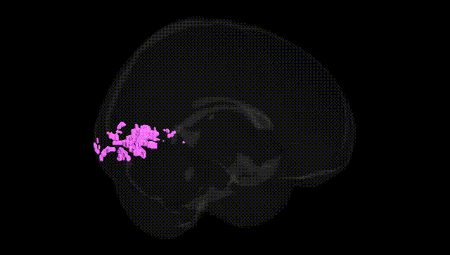 Full Brain Black