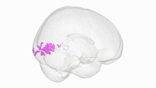Full Brain White