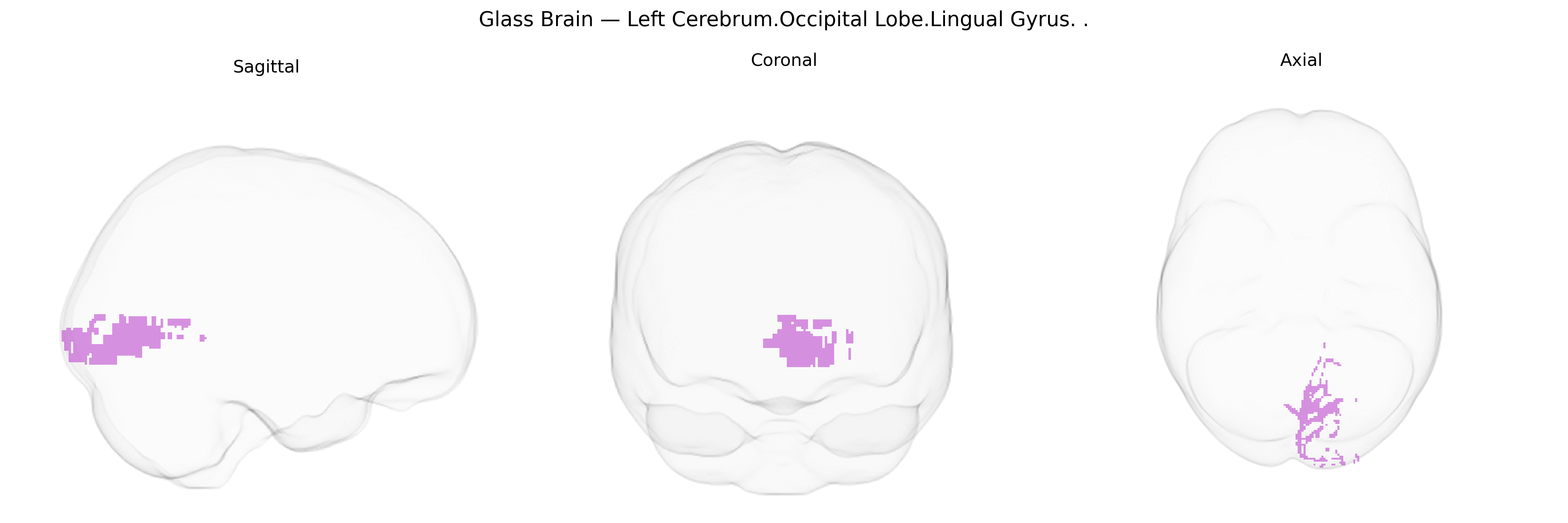 Triplanar Ghost Brain