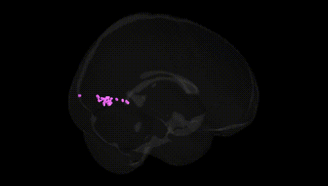 Full Brain Black