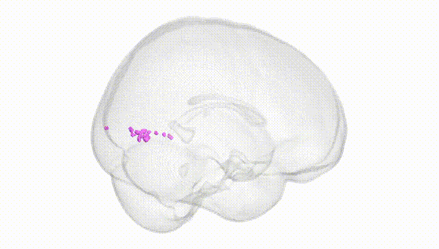 Full Brain White