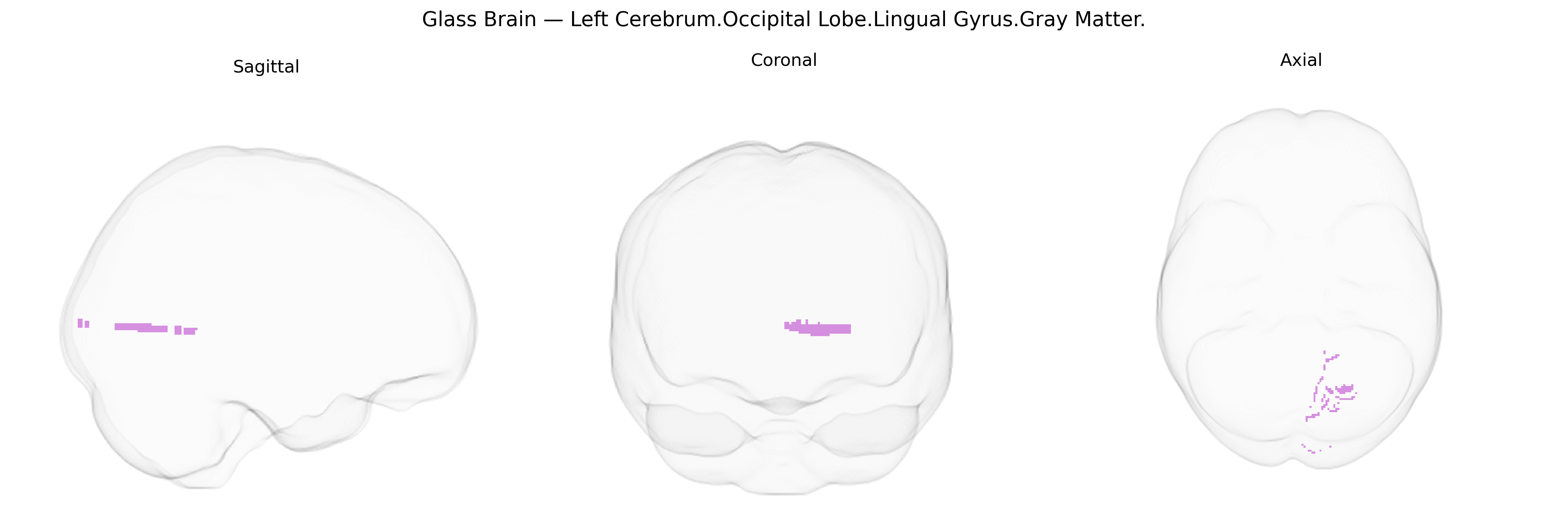 Triplanar Ghost Brain