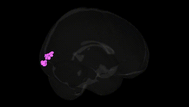 Full Brain Black
