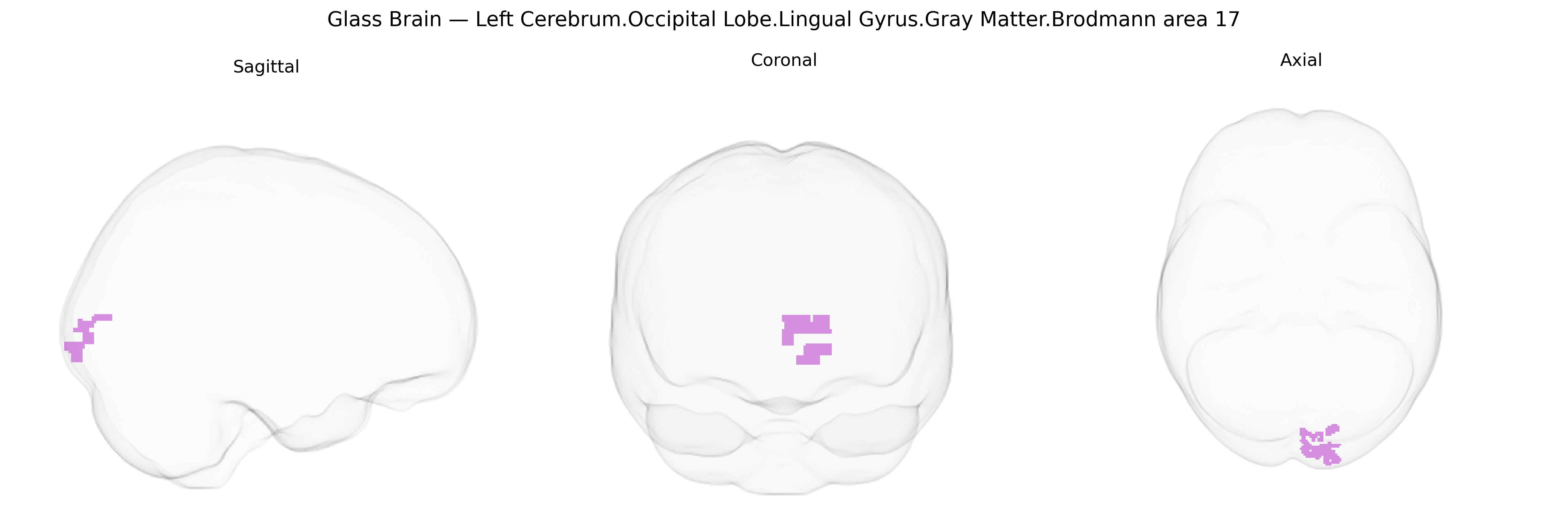 Triplanar Ghost Brain