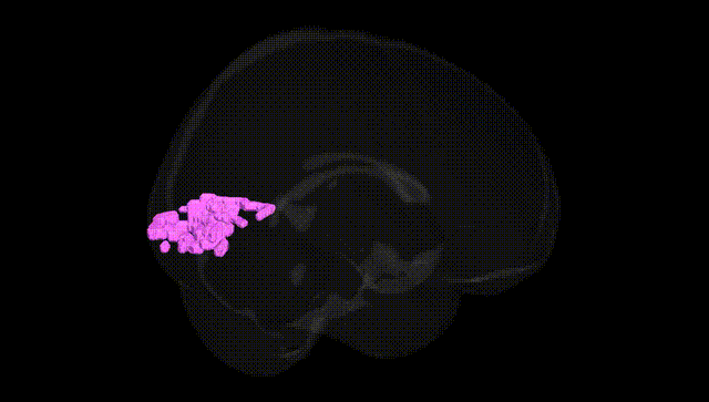 Full Brain Black