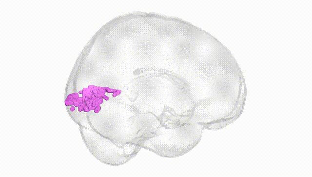 Full Brain White