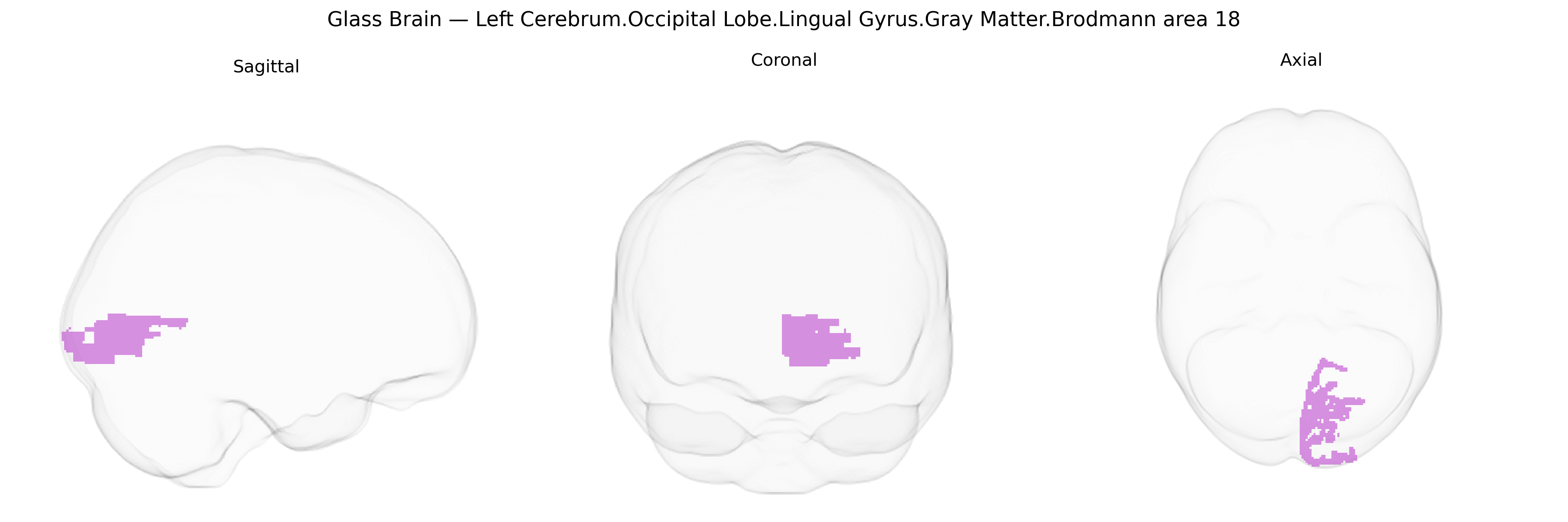 Triplanar Ghost Brain