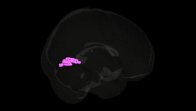 Full Brain Black
