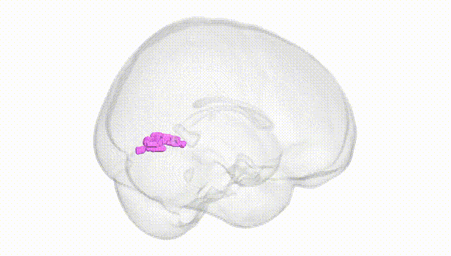 Full Brain White