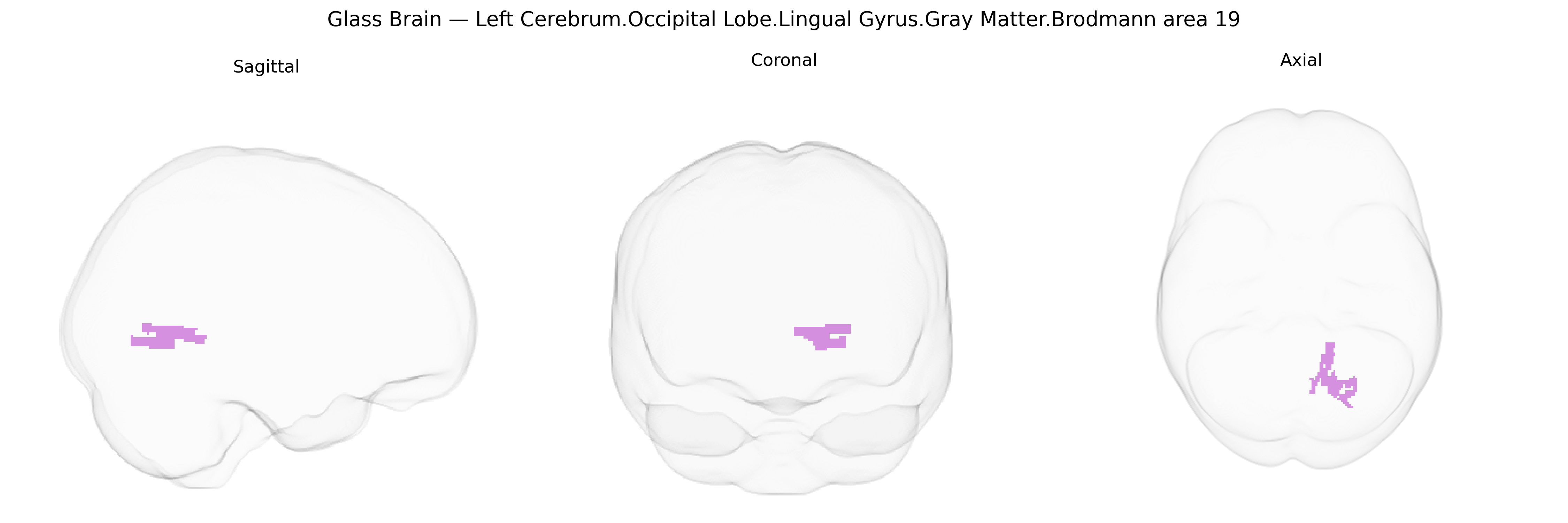 Triplanar Ghost Brain