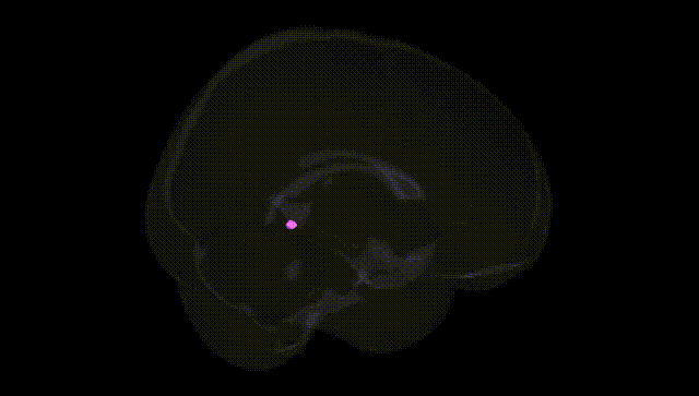 Full Brain Black