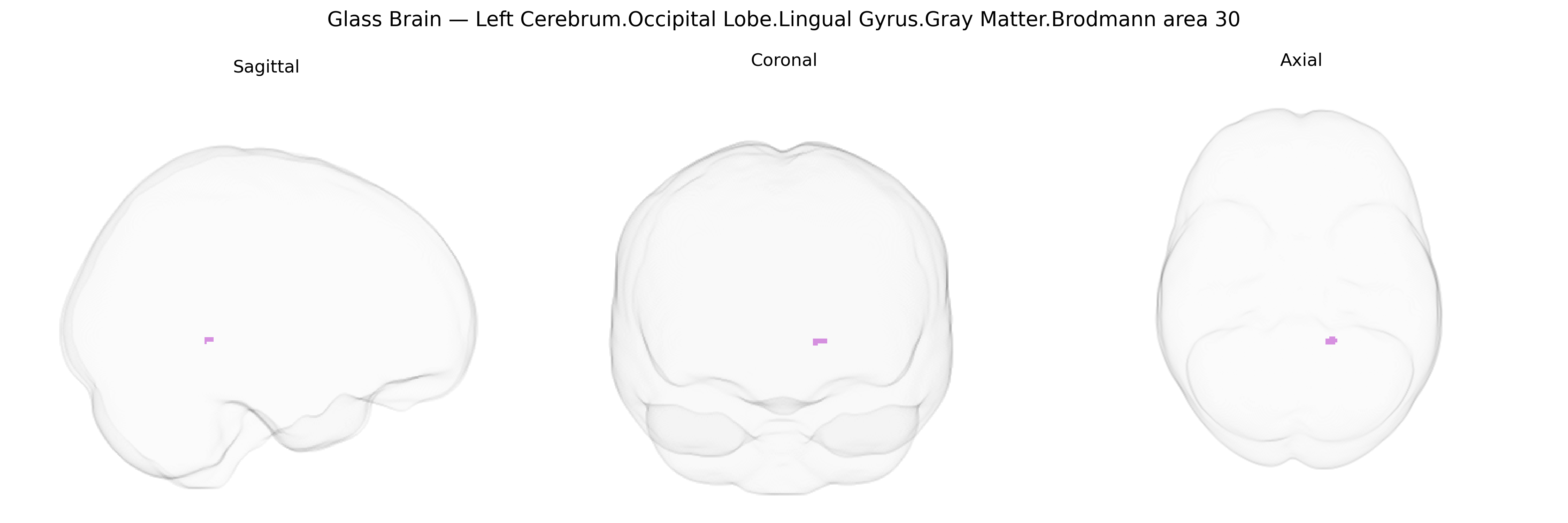 Triplanar Ghost Brain