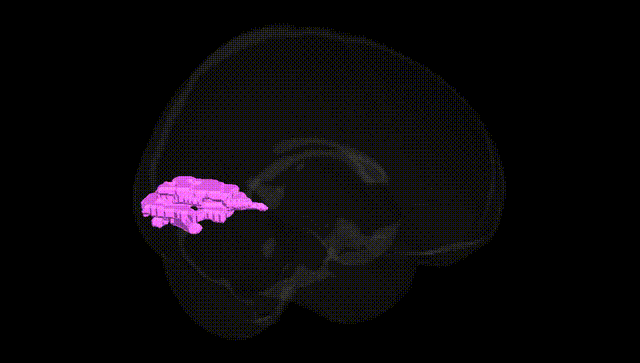 Full Brain Black