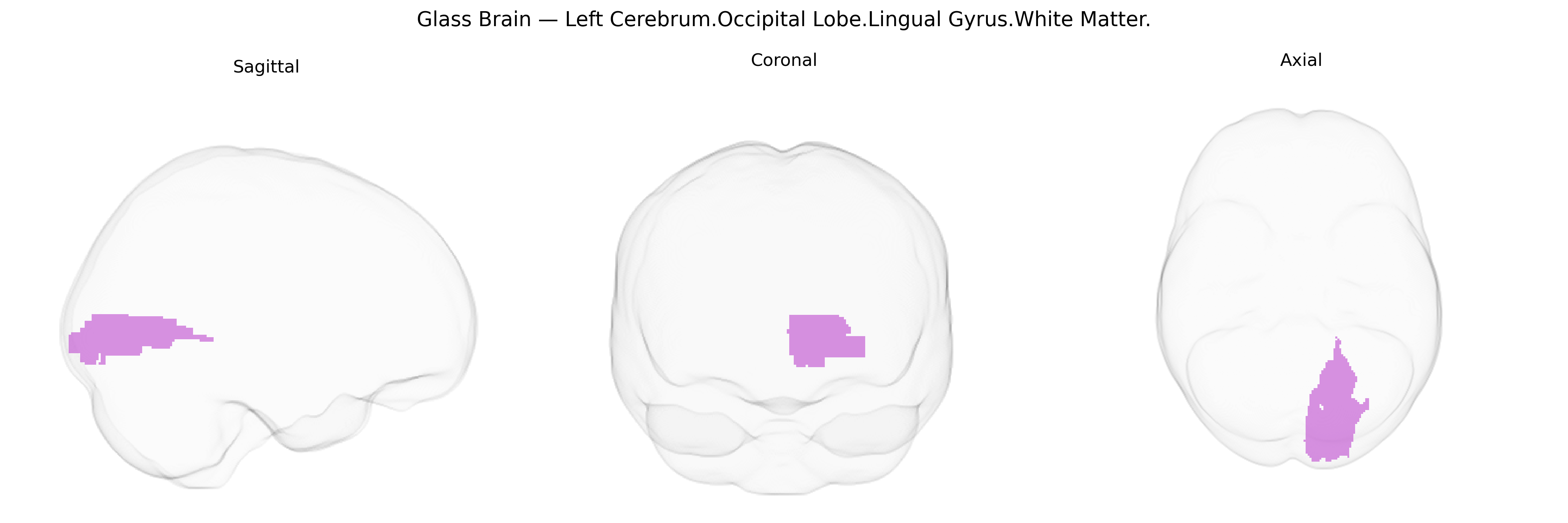 Triplanar Ghost Brain