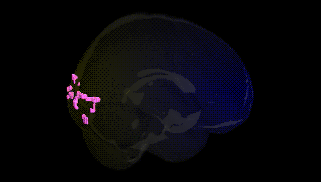 Full Brain Black