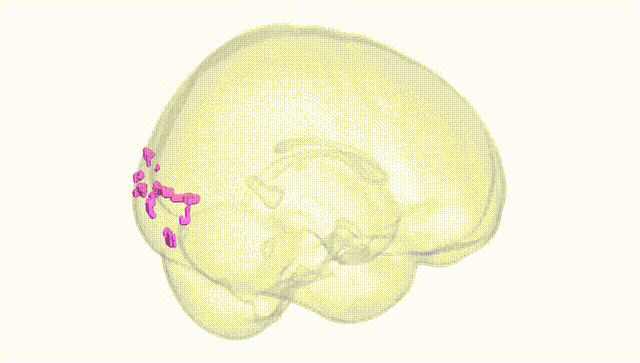 Full Brain White