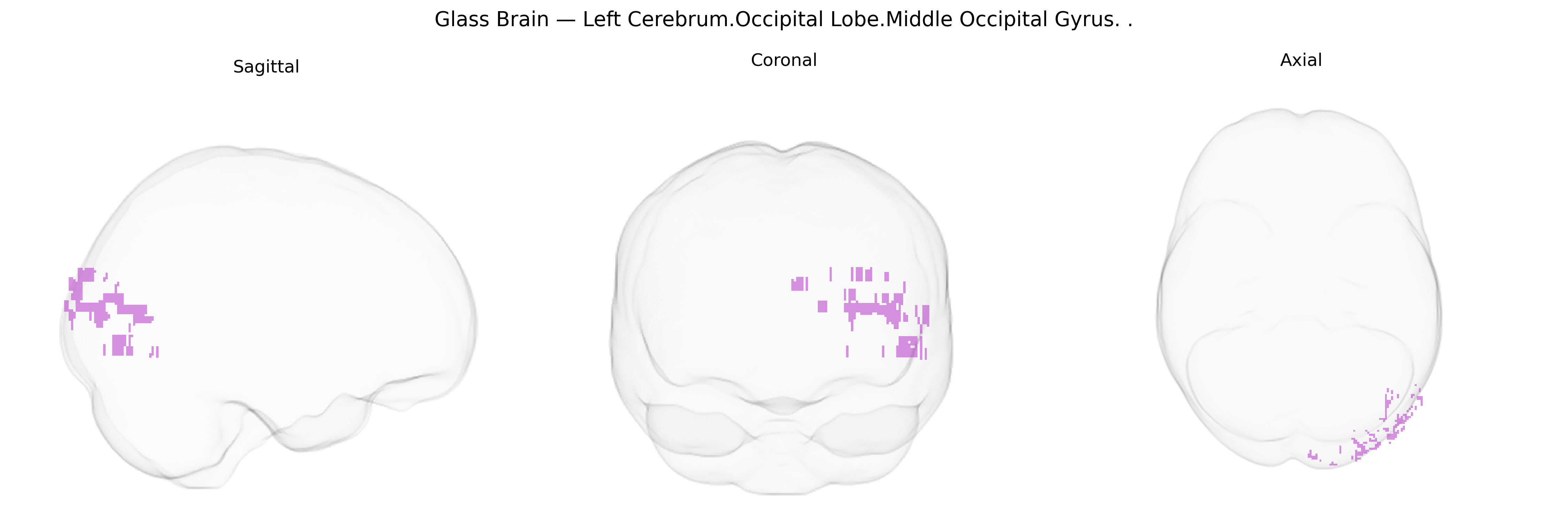 Triplanar Ghost Brain