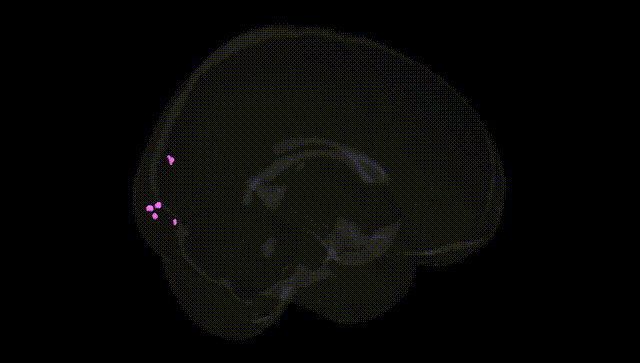 Full Brain Black