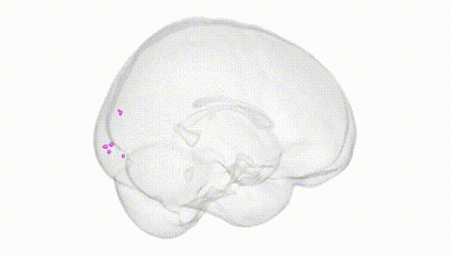 Full Brain White