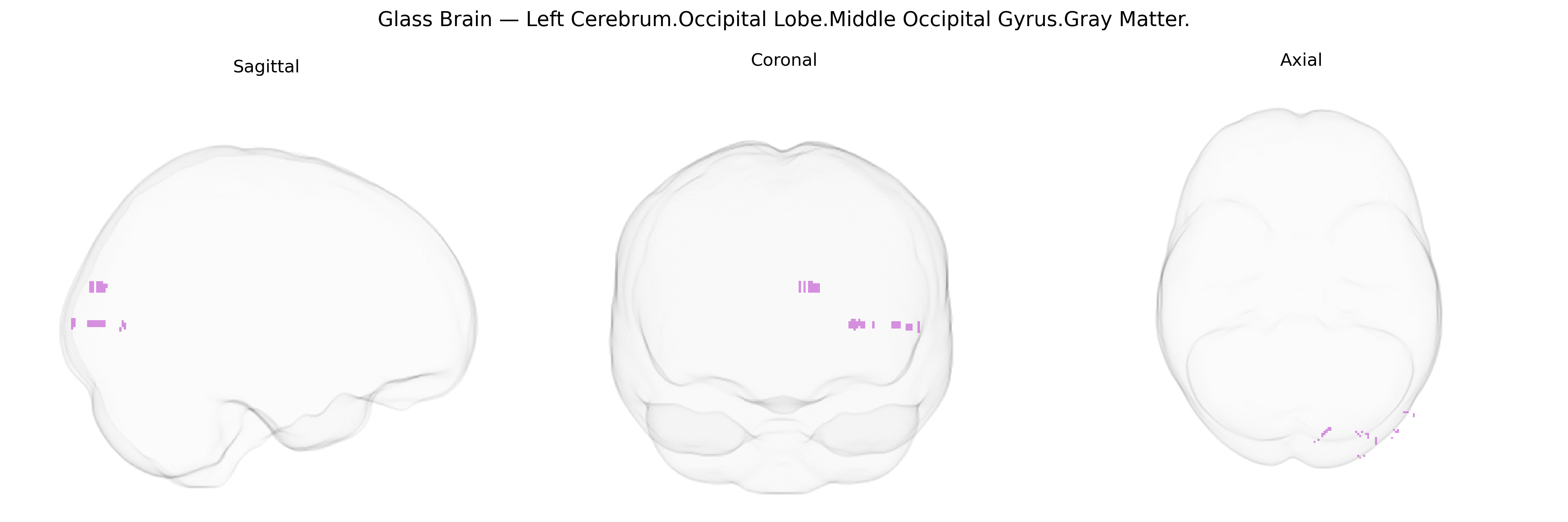 Triplanar Ghost Brain