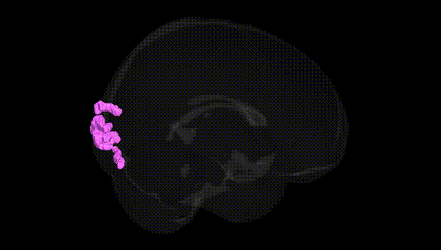 Full Brain Black