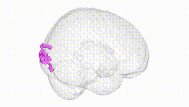 Full Brain White