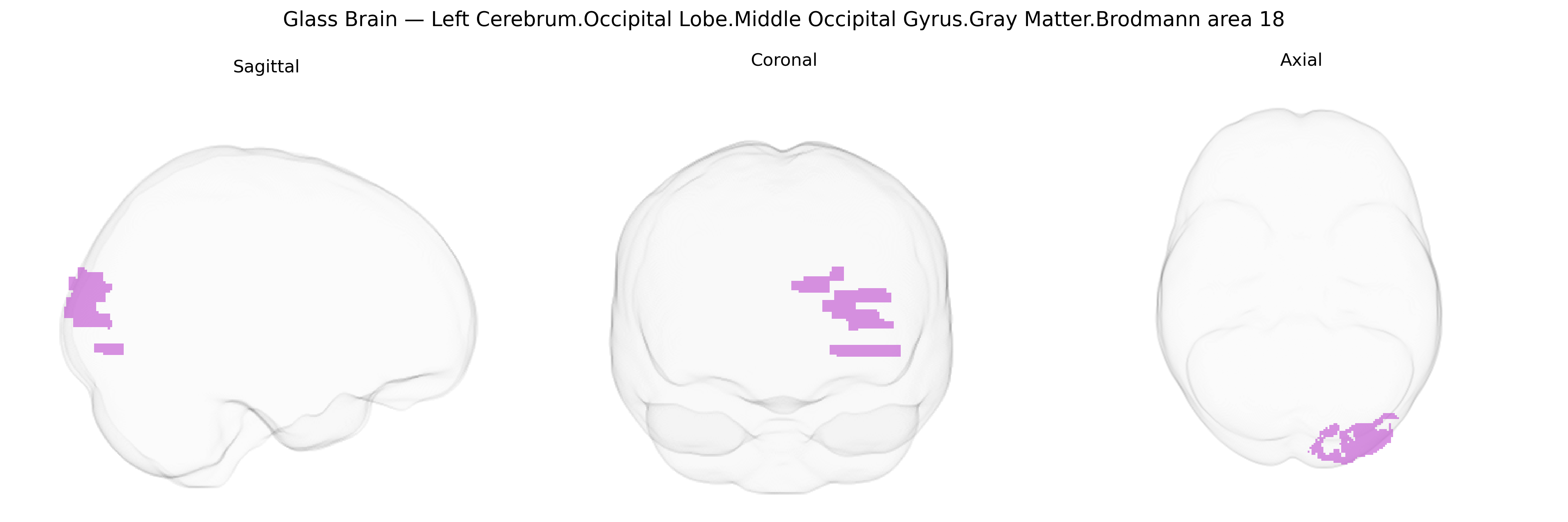 Triplanar Ghost Brain