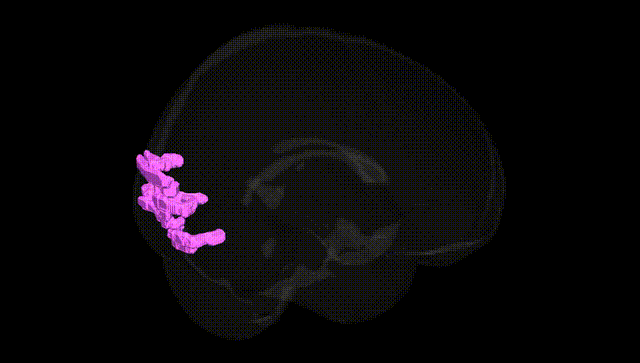 Full Brain Black