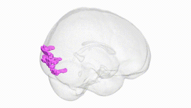 Full Brain White