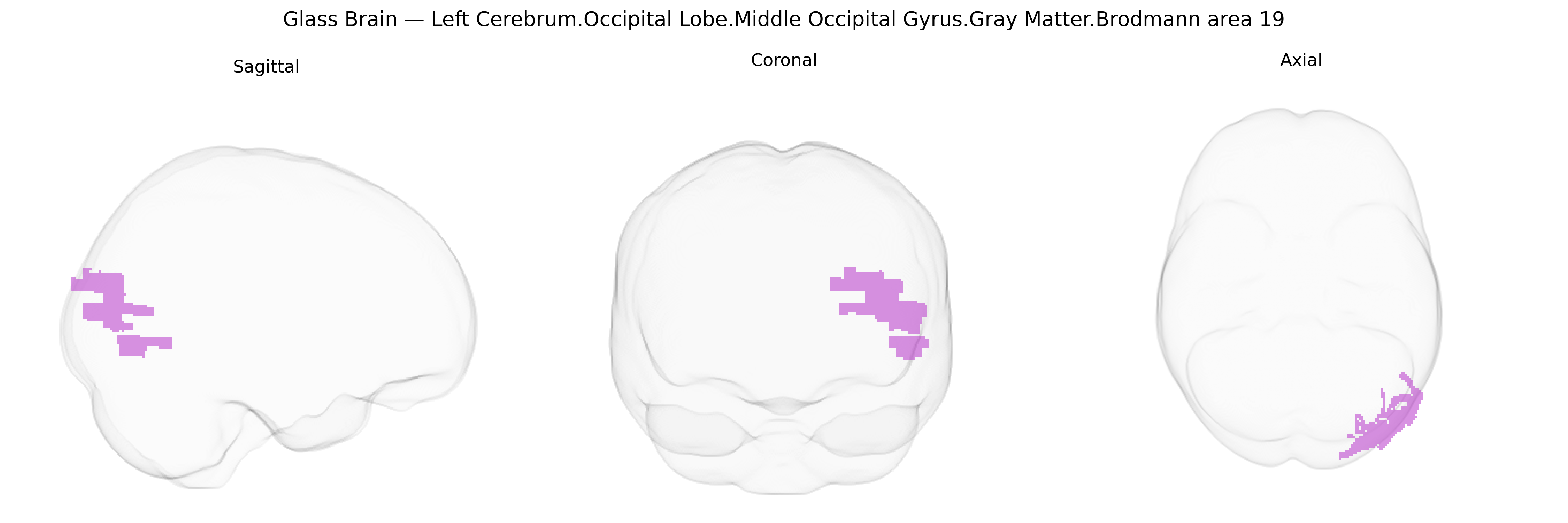 Triplanar Ghost Brain