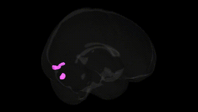 Full Brain Black