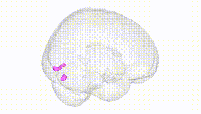 Full Brain White