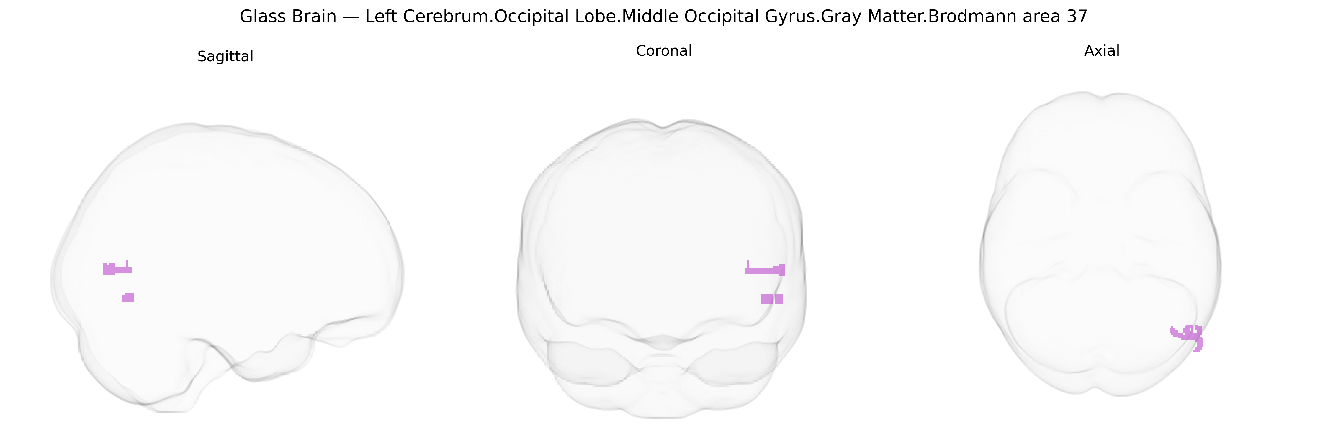 Triplanar Ghost Brain