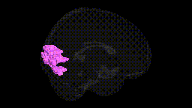 Full Brain Black