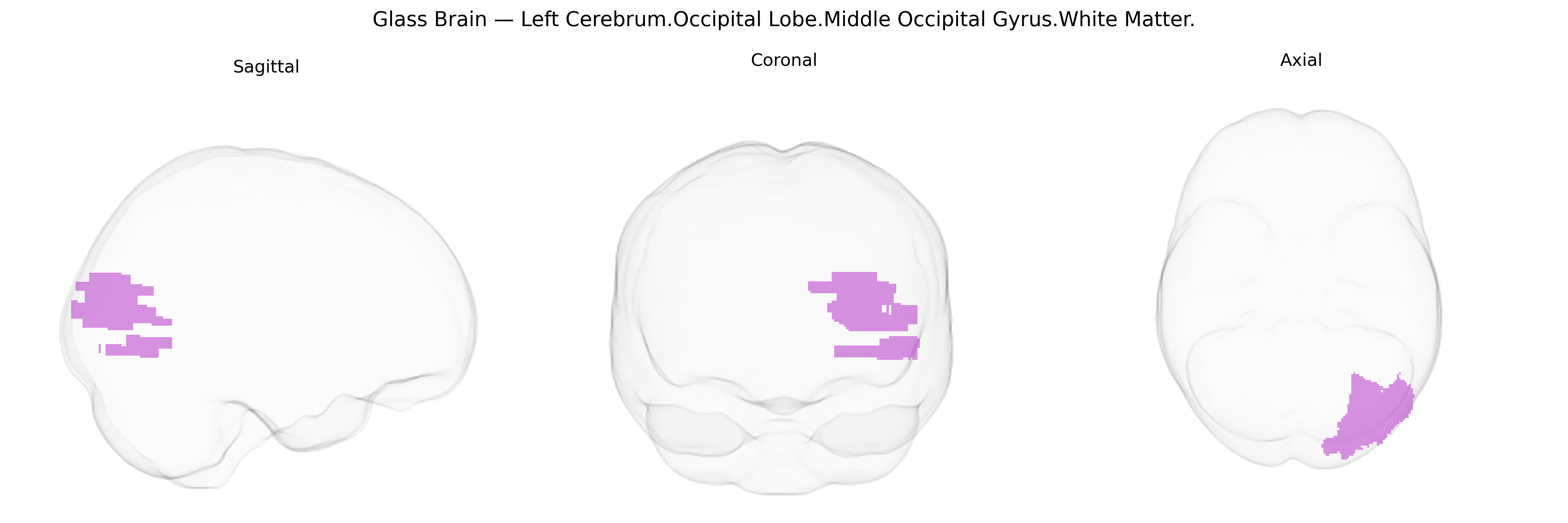 Triplanar Ghost Brain