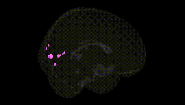 Full Brain Black