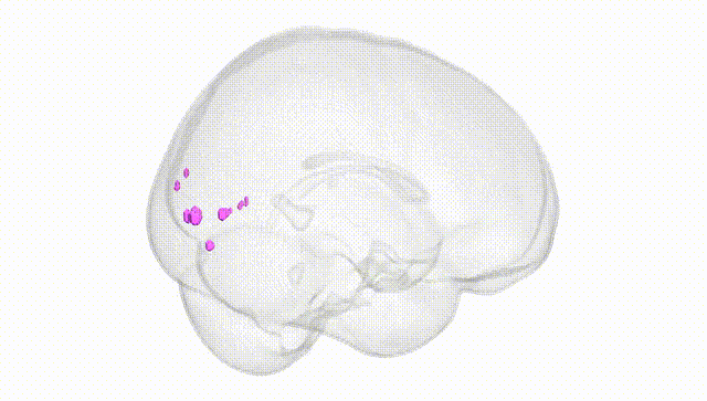 Full Brain White