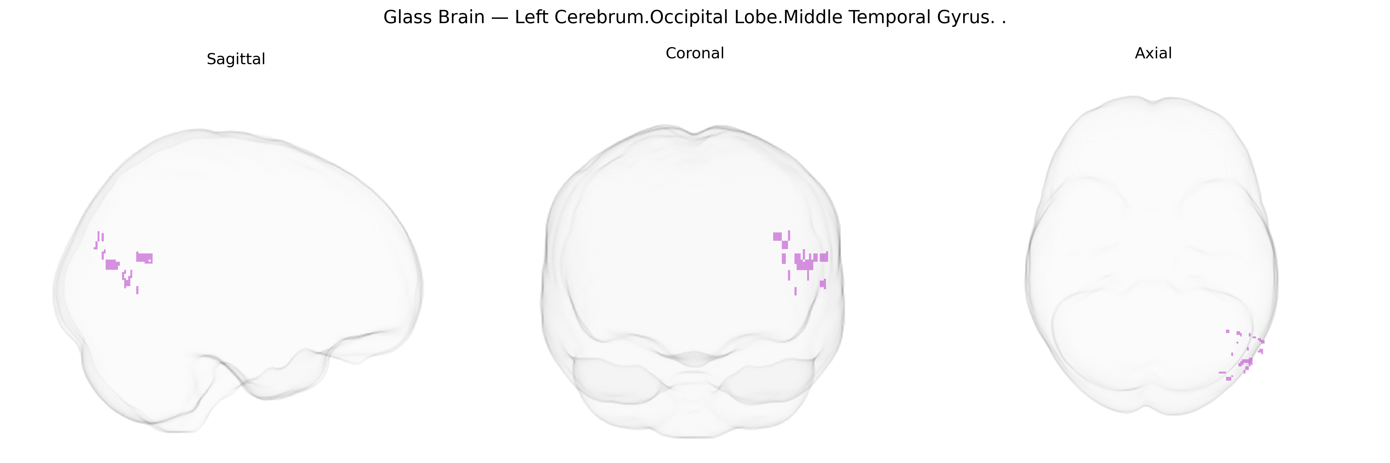 Triplanar Ghost Brain