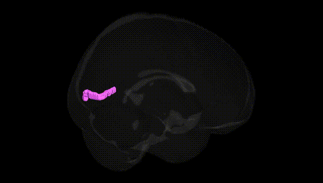 Full Brain Black