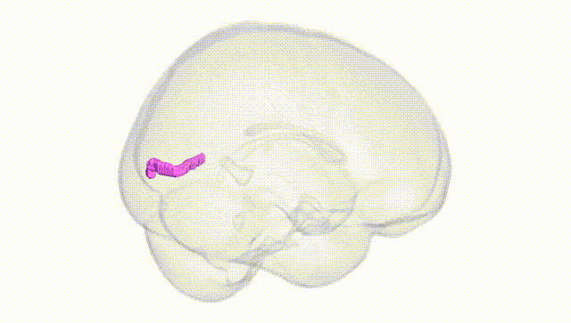 Full Brain White