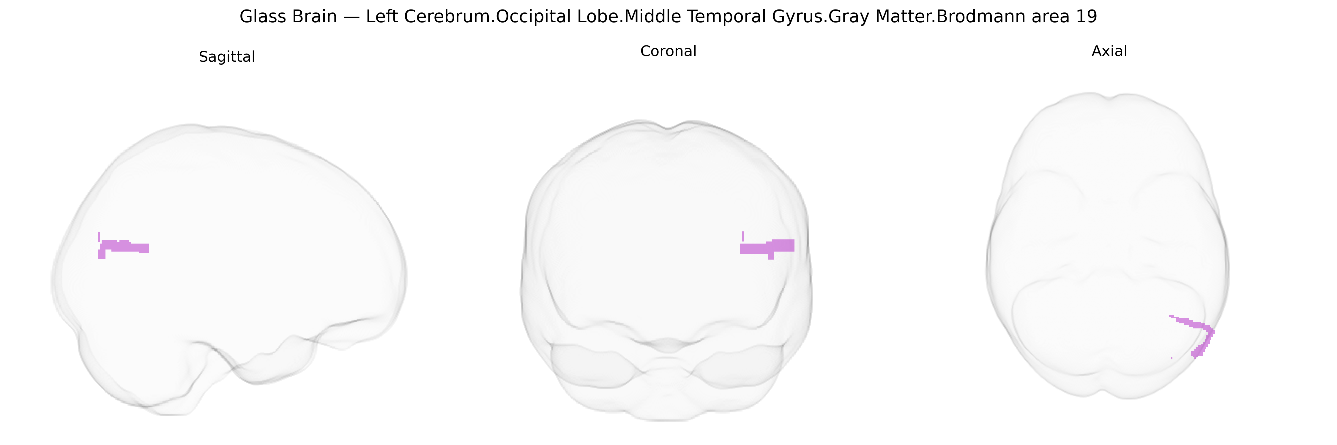 Triplanar Ghost Brain